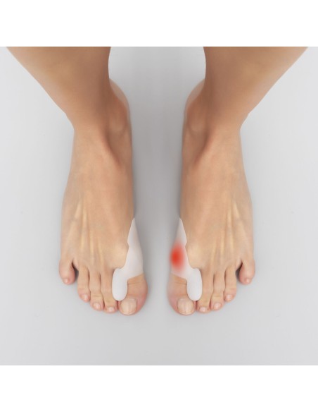 Correcteur et Protecteur pour Durillons en Silicone Bunilief InnovaGoods 2 Unités