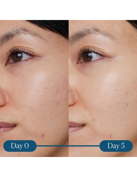 Sérum visage Elemis Dynamic Resurfacing 30 ml